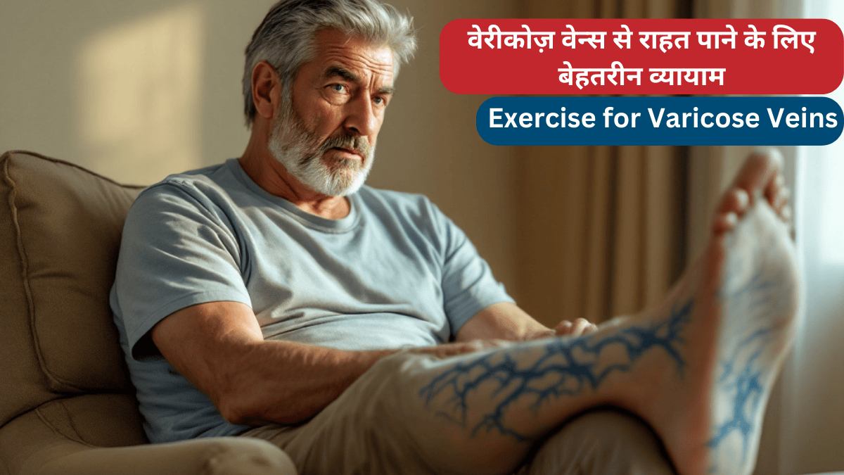 वेरीकोज़ वेन्स से राहत पाने के लिए बेहतरीन व्यायाम: Exercise for Varicose Veins